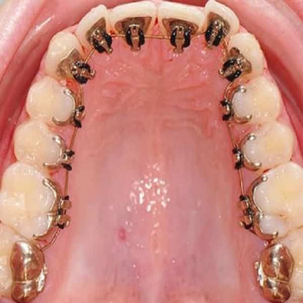 التقويم اللساني