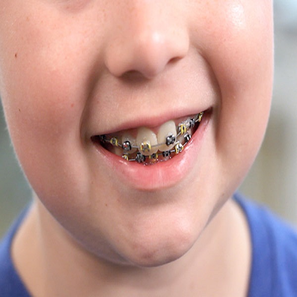 التقويم الوقائي عند الأطفال