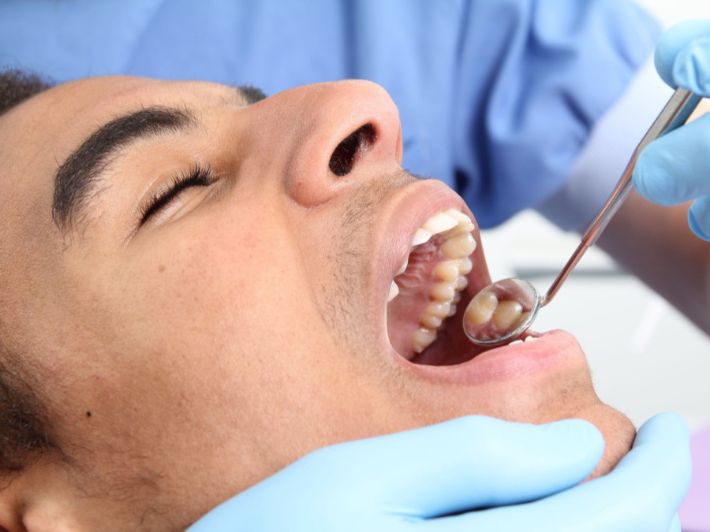 سقوط حشوة الأسنان