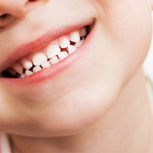 تأخر سقوط اسنان الأطفال